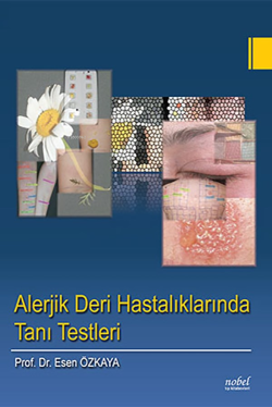 Alerjik Deri Hastalıklarında Tanı Testleri