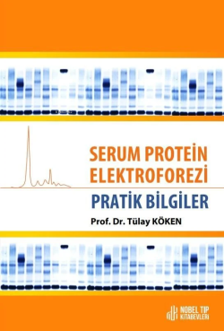 Serum Protein Elektroforezi - Pratik Bilgiler