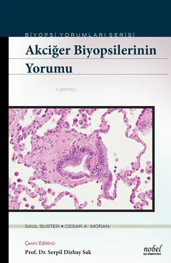 Akciğer Biyopsilerinin Yorumu - Biyopsi Yorumları Serisi - Serpil Dizb