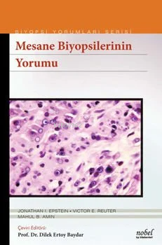 Biyopsilerin Yorumu:Mesane - Dilek Ertoy Baydar | Yeni ve İkinci El Uc