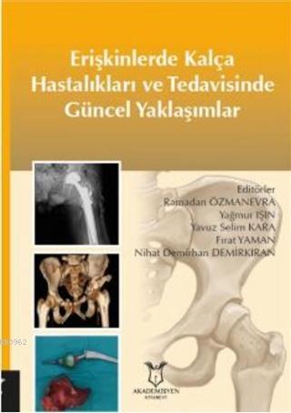 Erişkinlerde Kalça Hastalıkları ve Tedavisinde Güncel Yaklaşımlar - Ra