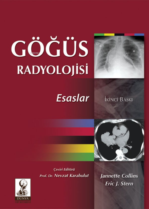 Göğüs Radyolojisi:Esaslar - Eric J. Stern | Yeni ve İkinci El Ucuz Kit