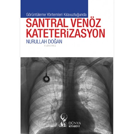 Görüntüleme Yöntemleri Kılavuzluğunda Santral Venöz Kateterizasyon - N