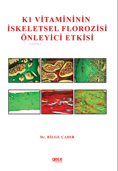 K1 Vitamininin İskeletsel Florozisi Önleyici Etkisi - Bilge Çadır | Ye