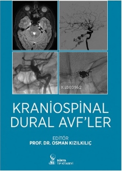 Kraniospinal Dural Avfler - Osman Kızılkılıç | Yeni ve İkinci El Ucuz 