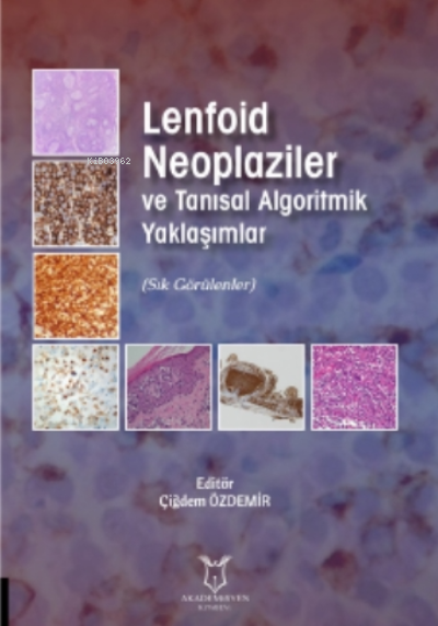 Lenfoid Neoplaziler ve Tanısal Algoritmik Yaklaşımlar - Çiğdem Özdemir