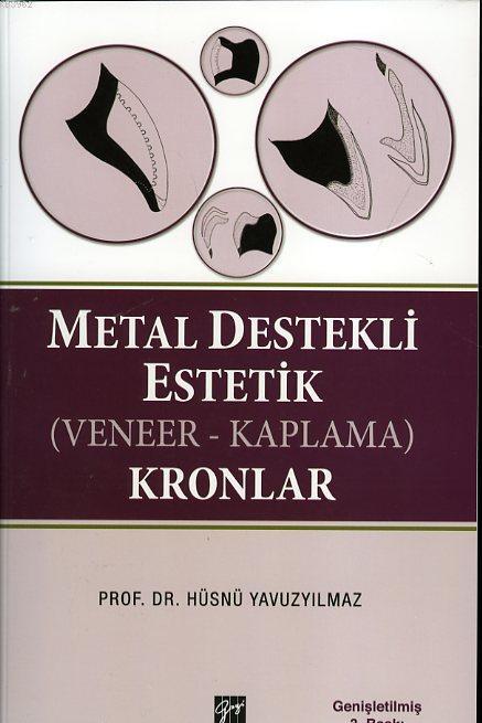 Metal Destekli Estetik (Veneer - Kaplama) Kronlar - Hüsnü Yavuzyılmaz 