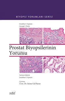 Prostat Biyopsilerinin Yorumu - Saime Gül Barut | Yeni ve İkinci El Uc