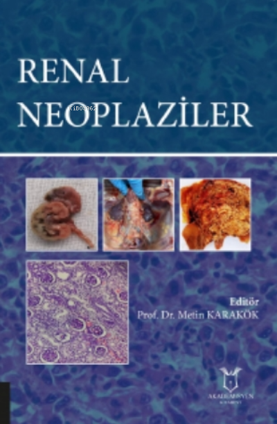 Renal Neoplaziler - Renal Neoplaziler | Yeni ve İkinci El Ucuz Kitabın