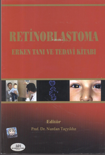 Retinoblastoma Erken Tanı ve Tedavi - Nurdan Taçyıldız | Yeni ve İkinc