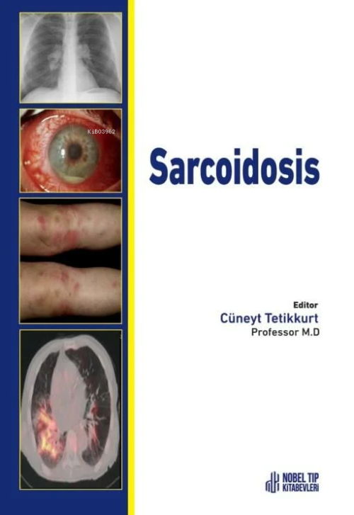 Sarcoidosis - Cüneyt Tetikkurt | Yeni ve İkinci El Ucuz Kitabın Adresi