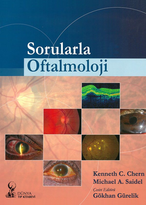 Sorularla Oftalmoloji - Michael A. Saidel | Yeni ve İkinci El Ucuz Kit