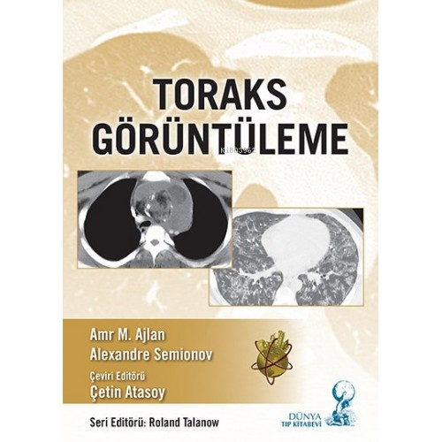 Toraks Görüntüleme - Çetin Atasoy | Yeni ve İkinci El Ucuz Kitabın Adr